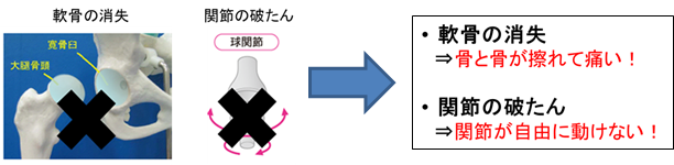 股関節機能の障害図