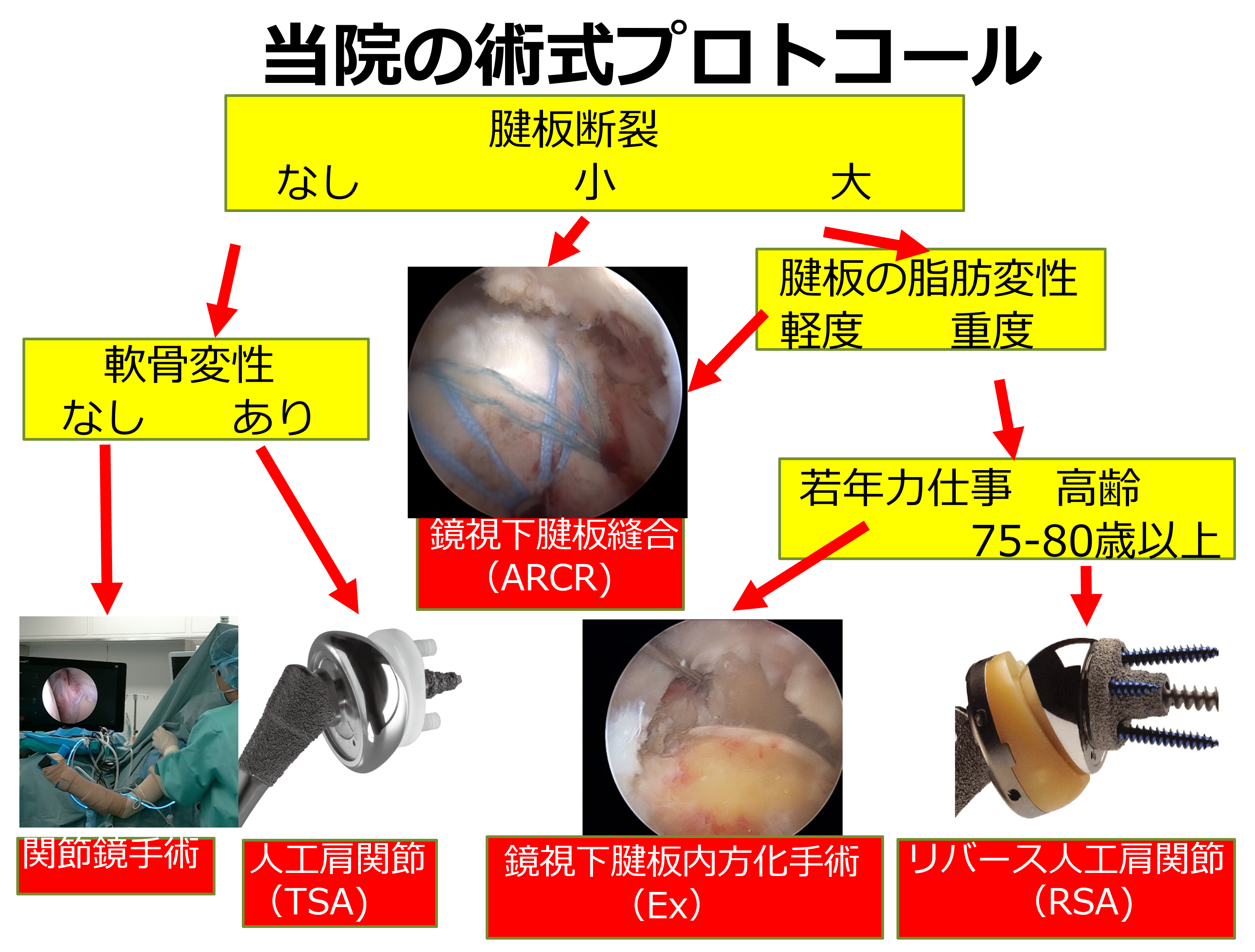 当院の術式プロトコール