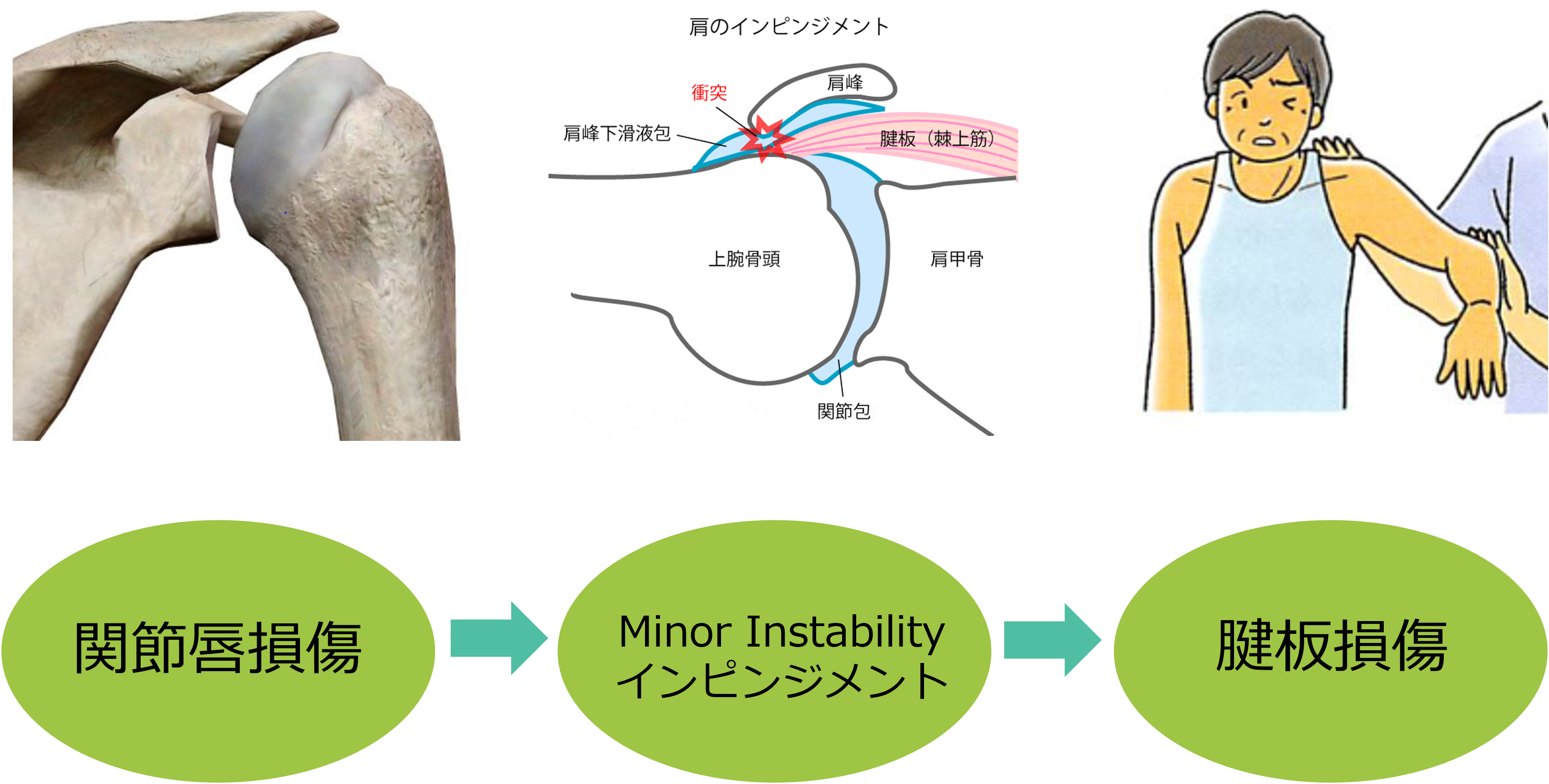 肩