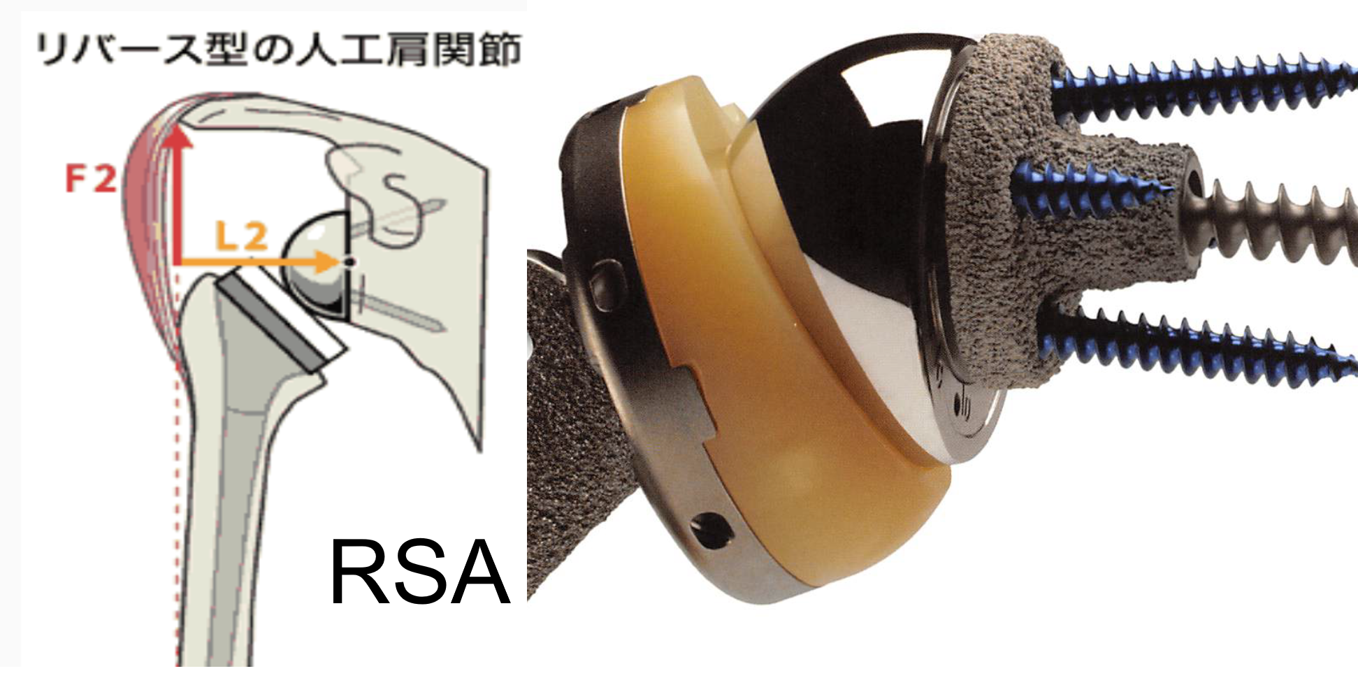 RSAのメカニズム