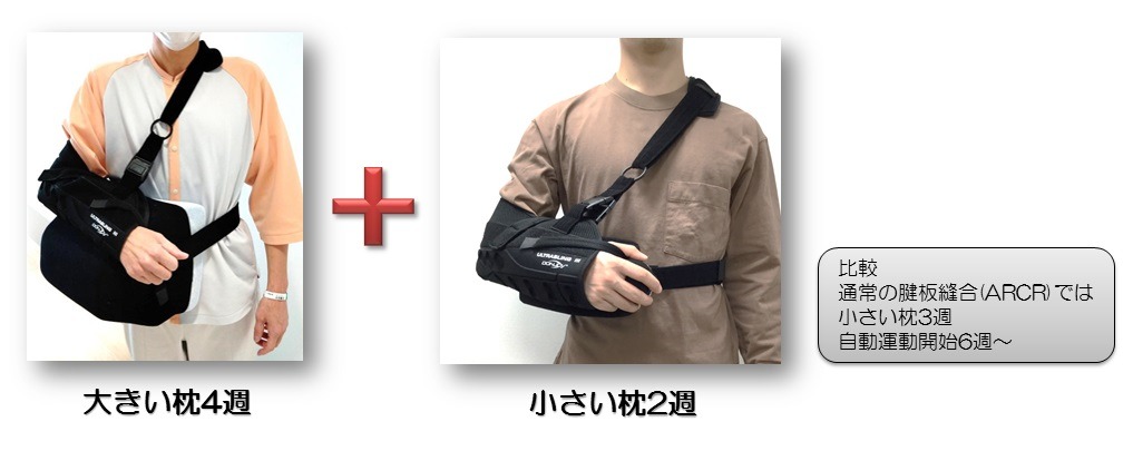 リハビリテーションの様子