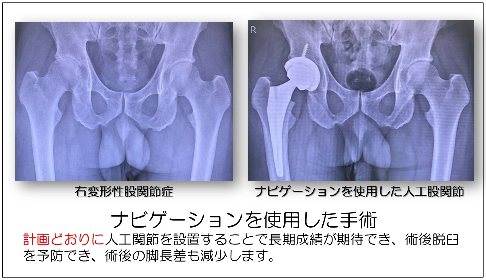 ナビゲーション手術の様子