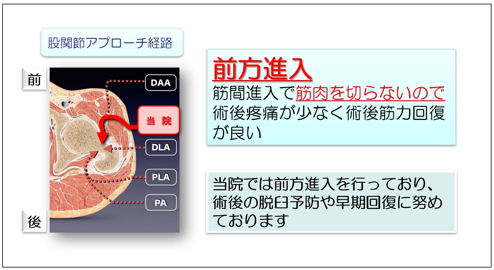 低侵襲手術のイメージ