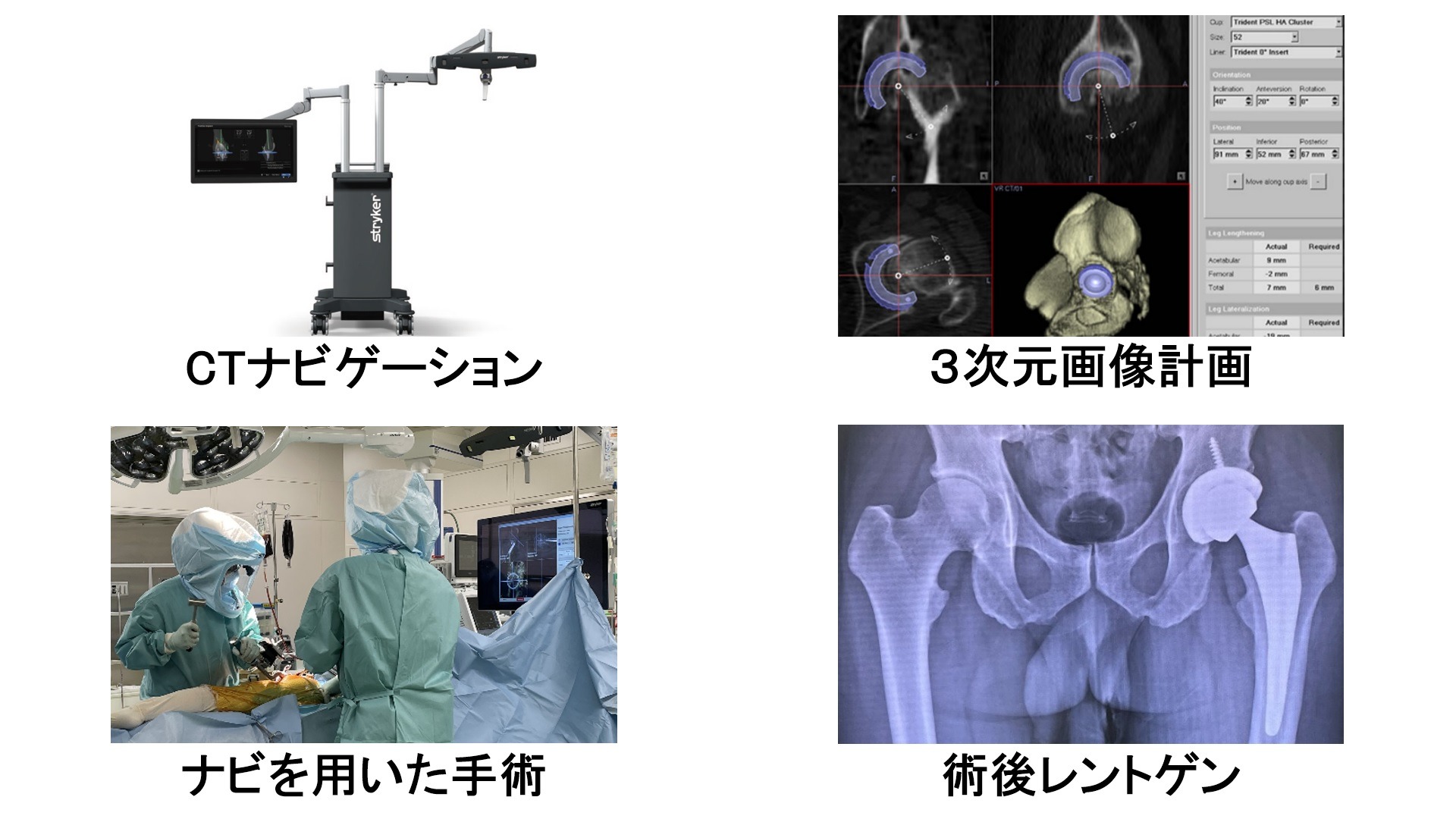 ナビゲーションシステム