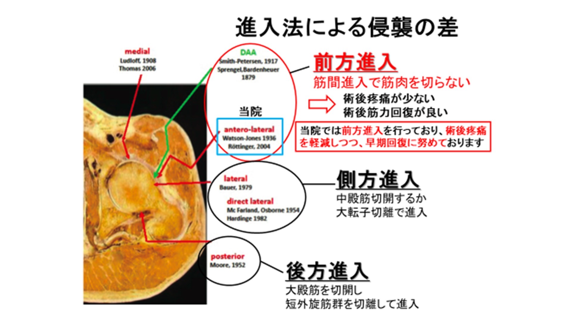 低侵襲手術のイメージ1