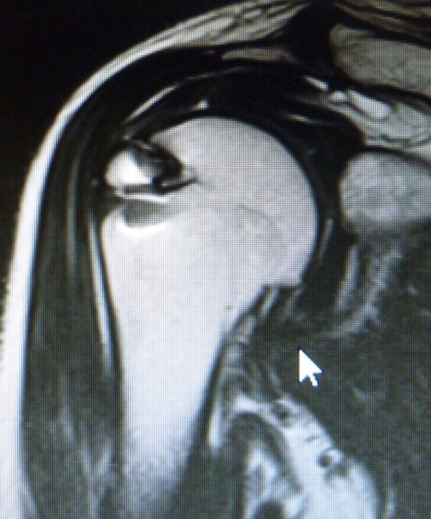 退院後の診察及びリハビリ