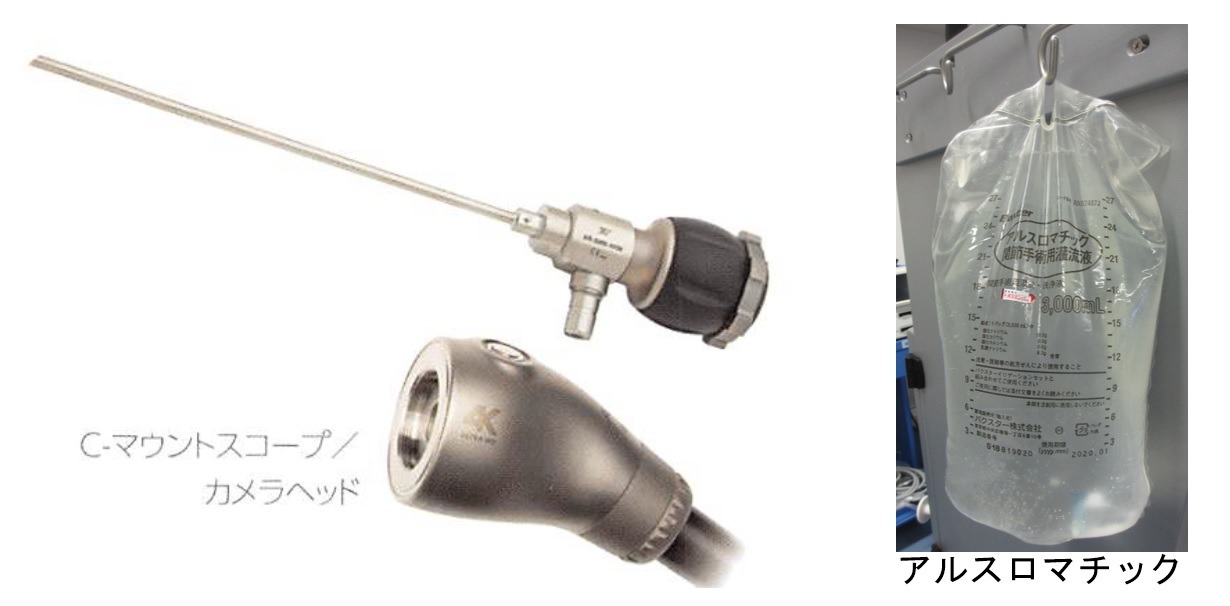 肩関節鏡手術とは