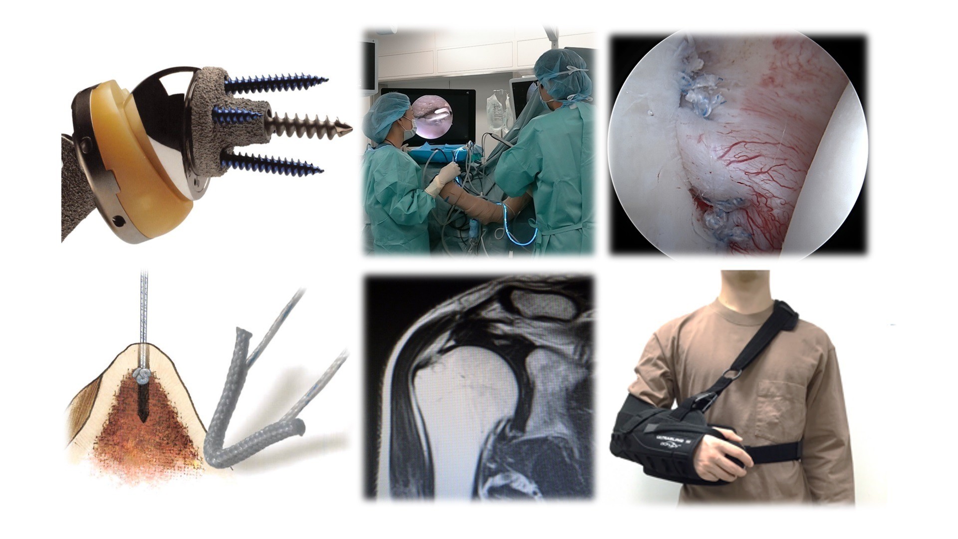 当院の肩関節手術