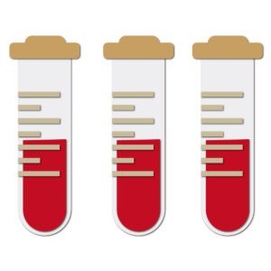 手術前の採血について