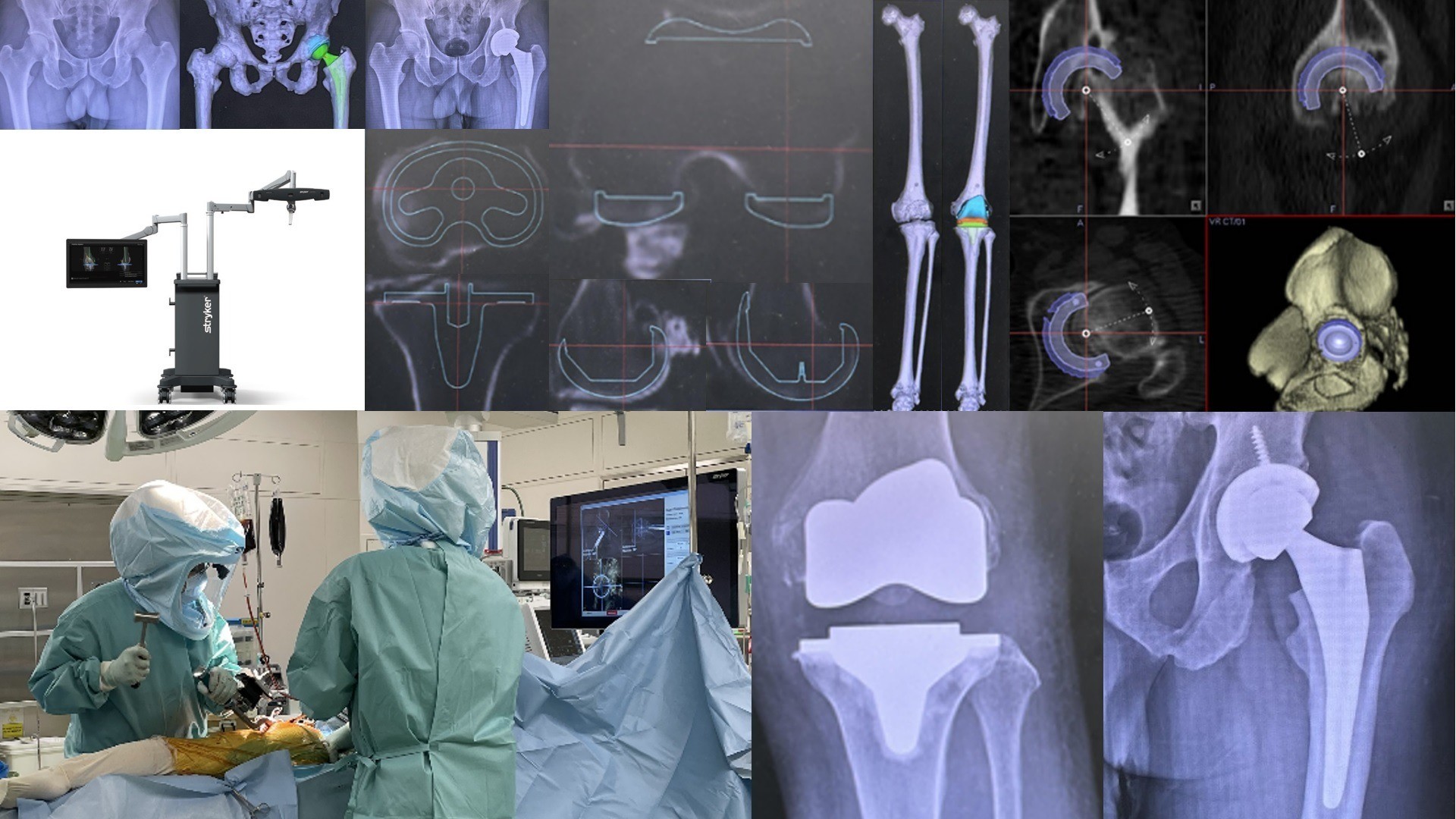 人工関節クリニック