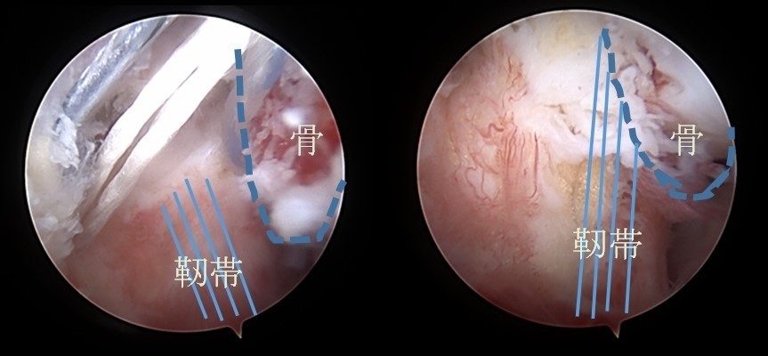手術を要する足関節疾患
